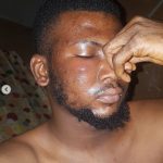 DJ Muse Brutalized By Police For Not Having Hangout App On His Phone (Photos)